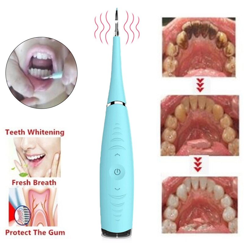 Détartreur dentaire sonique à Vibration, Recharge USB, dissolvant de tartre, taches, outil de nettoyage, blanchiment des dents, directe