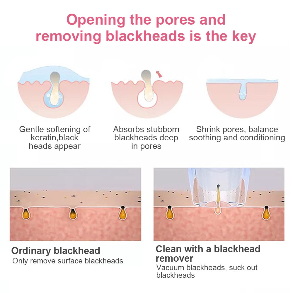 Blackhead Remover Vacuum Electric Nose Face Deep Cleansing Skin Care Machine Blackhead Remover Black Spots Pore Cleaner T Zone