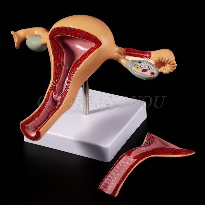 Human Pathological Uterus Ovary Model Anatomical Anatomy Disease Pathology Lesion For Teaching