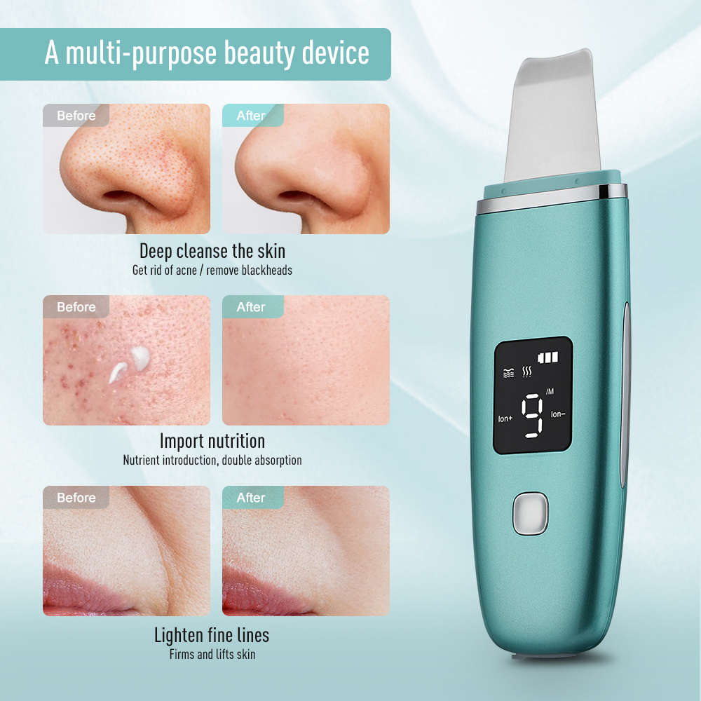 Ultrasonic Face Cleaner Skin Scrubber Ultrasound Vibration Massager Ultrasound Peeling Clean Tone Lift Scrubber