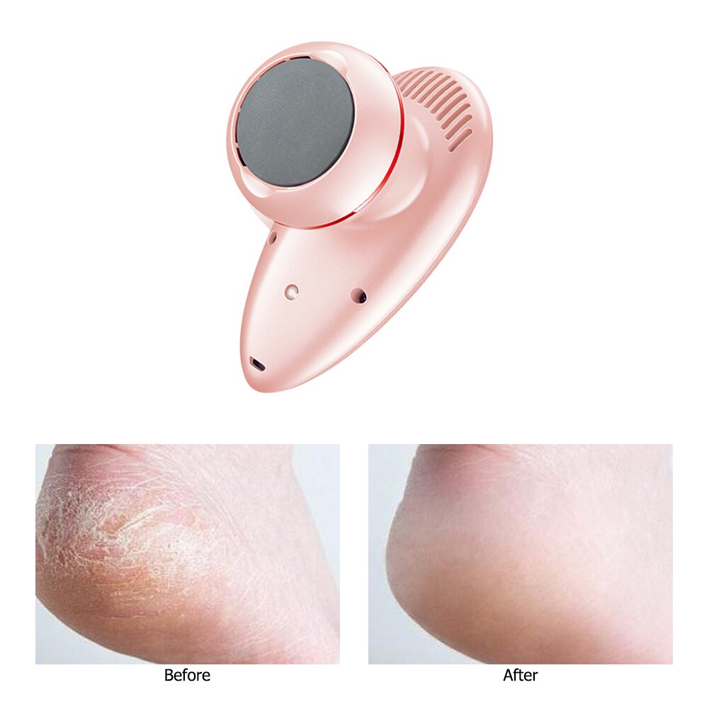 Fichier de pied électrique USB charge électrique pied broyeur peau morte callosités dissolvant pied polisseur pédicure outils soins des pieds pour wemen