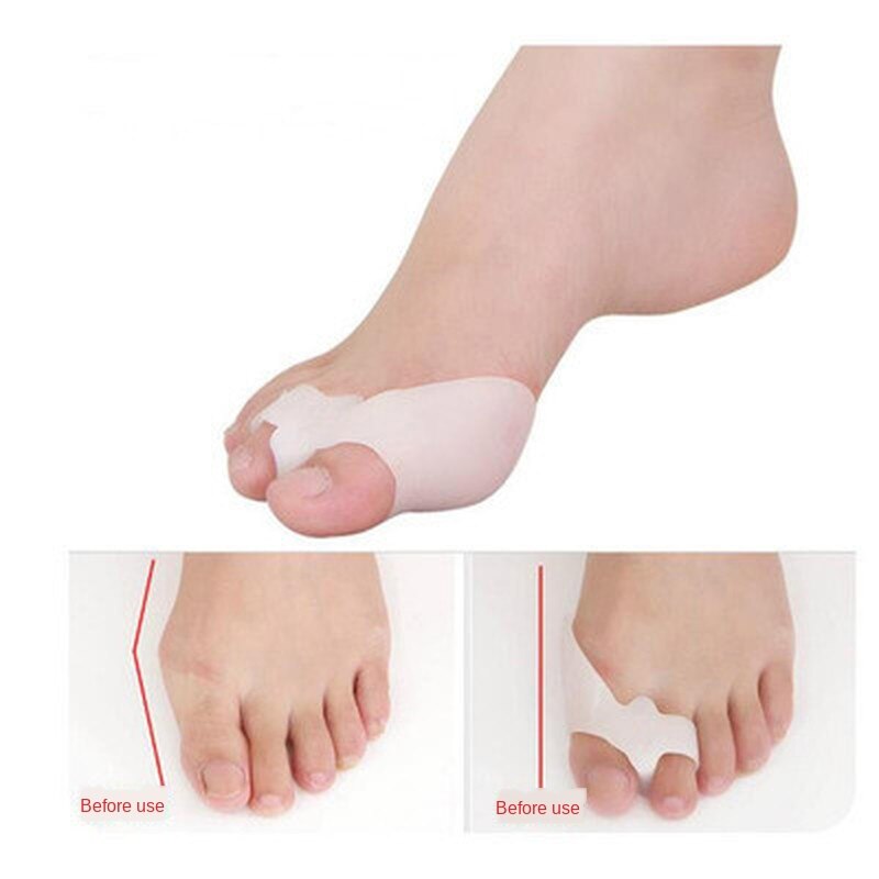 soin orthopédique des pieds, 2 pièces = 1 paire, attelle spéciale, protection du pouce en Gel de Silicone, séparateur d'orteils, redresseur, outils de soins