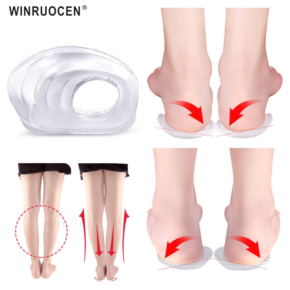 Silikonigeeli unisex o/x jalka valgus varus korjaaja ortoottiset pohjalliset jalkapehmusteet kantapää korjaavat tyynyt litteät jalat