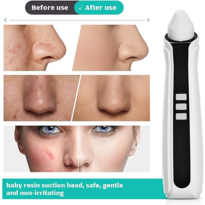 Eliminador de espinillas recargable al vacío, aspirador de poros facial con cámara con 3 niveles de intensidad y 3 puntas intercambiables