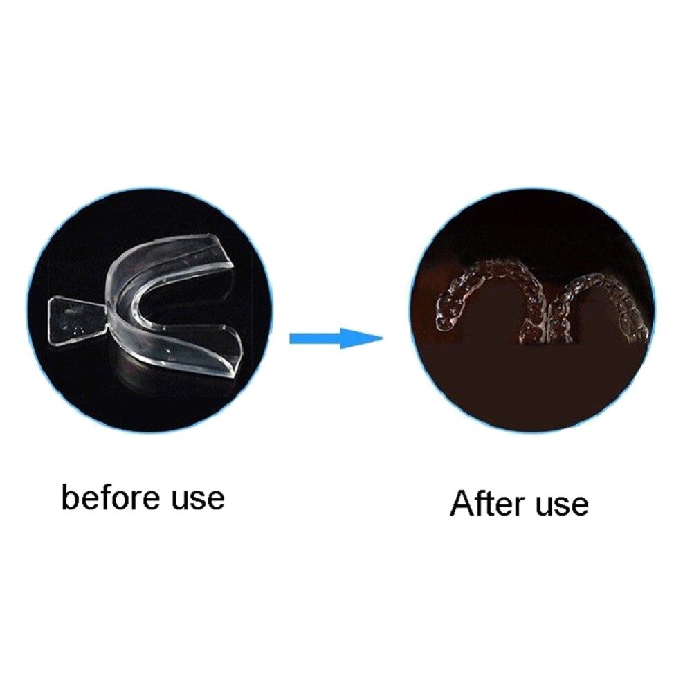 Novo 4 pçs silicone noite protetor de boca para os dentes clenching moagem dental mordida sleep aid branqueamento dentes boca bandeja