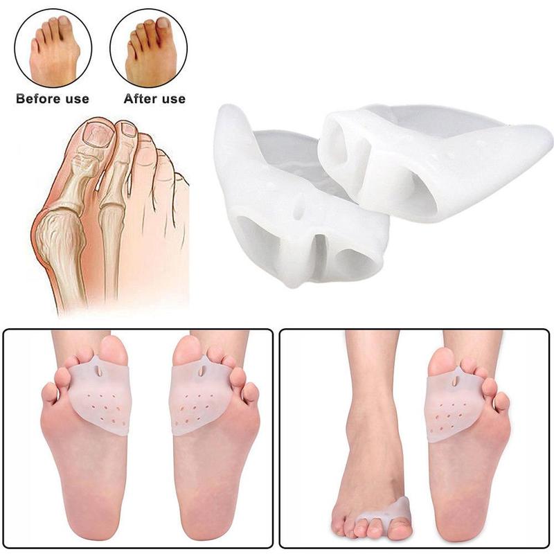 1 paire Hallux Valgus accolades Correction des orteils Broadhurst orteil sous-orteil séparateur remédical outil coussinet pied soins quotidiens Y5A5