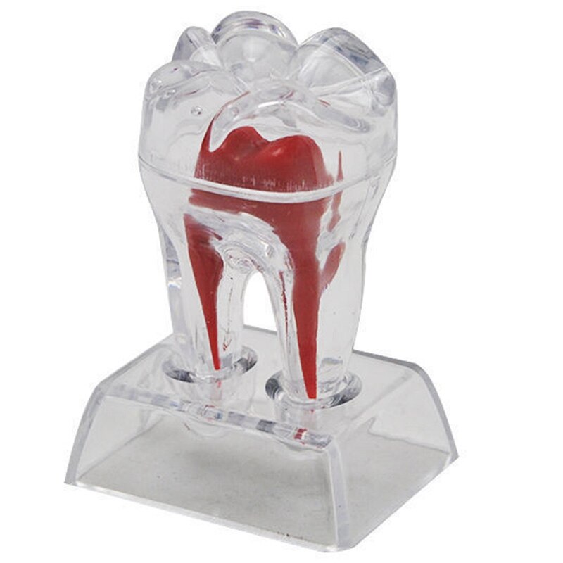 Large Tooth Molar Model Separable Teaching Demonstration Model Transparent Dentistry Material Lab Teeth Model