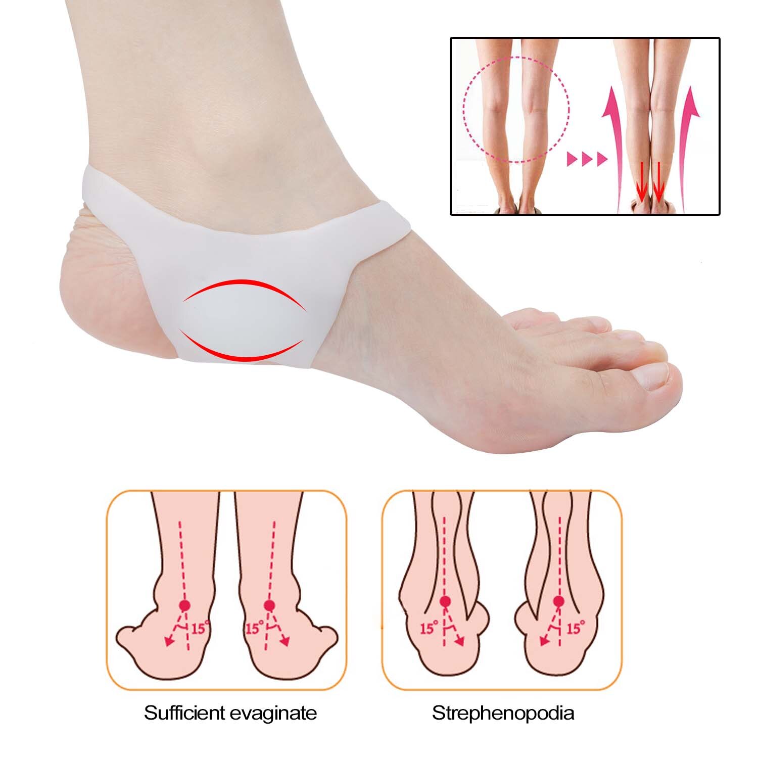 Sumifun 2 pièces o-type pied correcteur semelles tampons pas de chaussures antidérapantes pour hommes et femmes Silicone semelles orthopédiques soins des pieds
