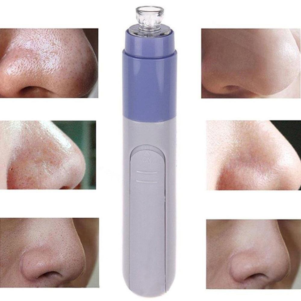Electric Facial Pore Blackhead Cleaner Remover Vacuum Acne Microdermabrasion Facial Pore Cleanser Blackhead Suction Remover