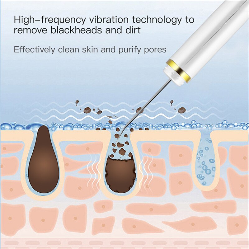 Ultrasonic Skin Scrubber Vibration Face Spatula Facial Pore Cleaner Blackhead Remover Exfoliator Peeling Shovel Lifting Massager