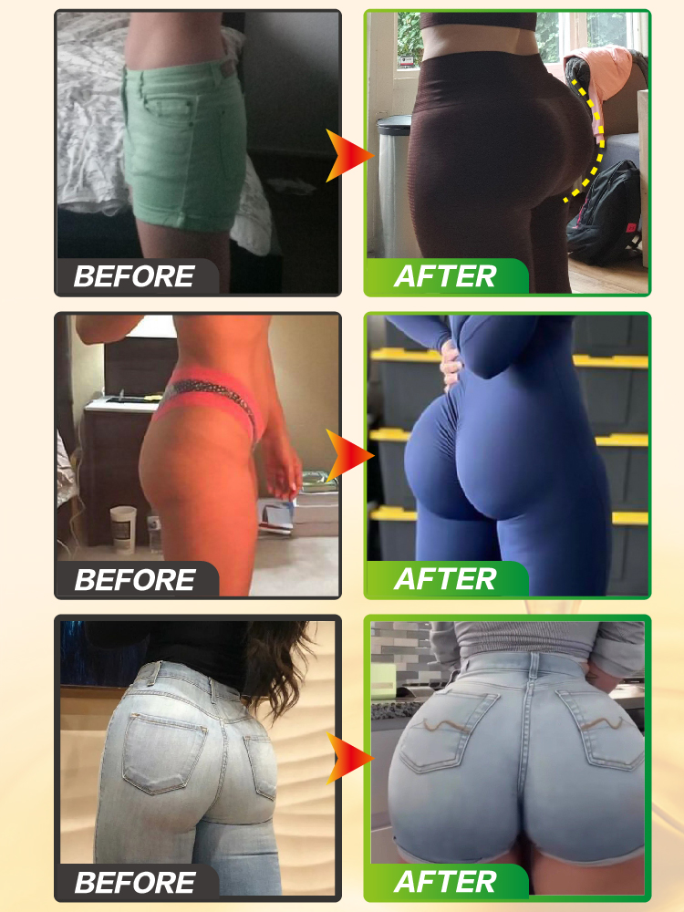Women Hip Enhancer without exercise