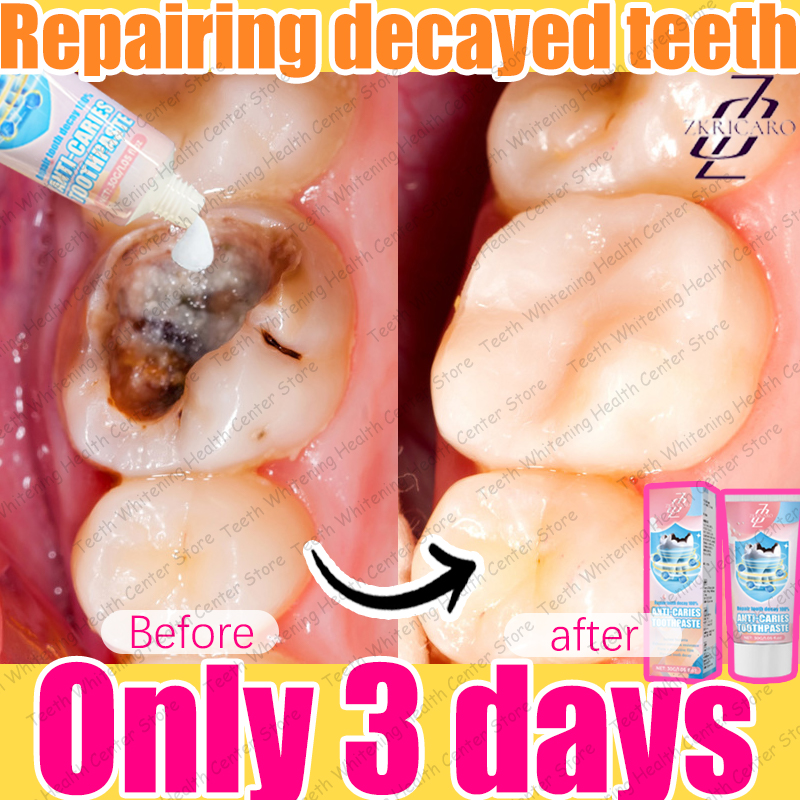 Latest Teeth Cleaning to Eliminate Tooth Decay