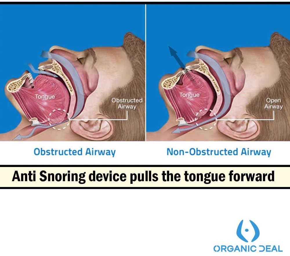 Anti snorken mundstykke tungeholder hjælper med at fjerne snorken anti snorkenhed silikone snorken søvnapnø anti ronflement
