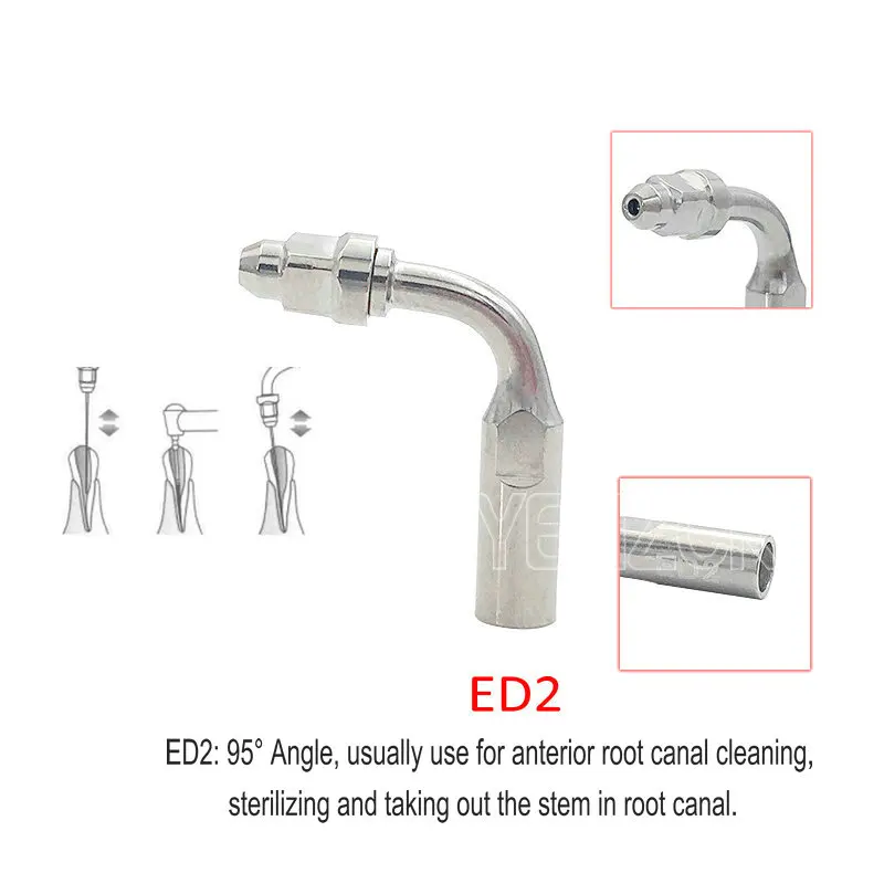 Puntas de escalador ultrasónico Dental, compatibles con escalador ultrasónico Satelec/DTE ED1/ED2/ED3/ED4/ ED5, 1 ud.: Rojo