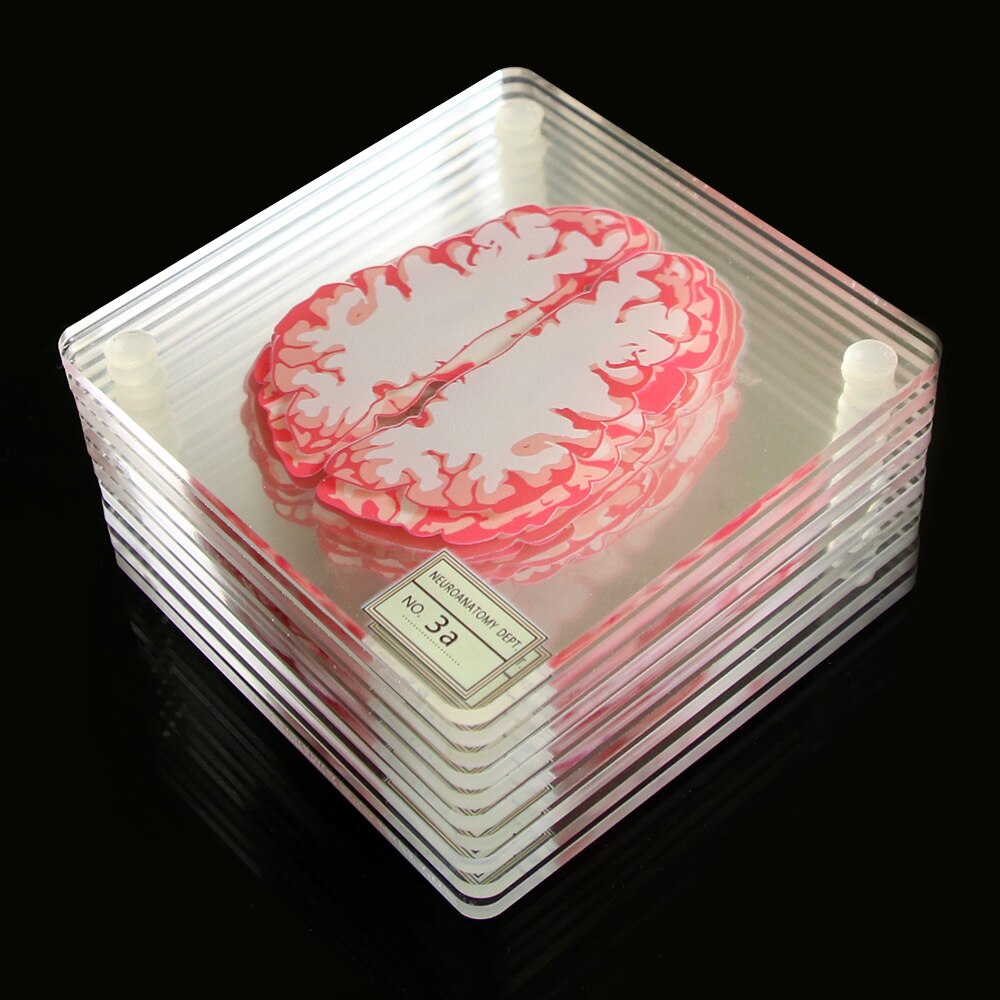 10Pieces/Set 3D Organ Brain Specimen Coasters Set Drinks Table Coaster Brain Slices Square Acrylic Glass Drunk Scientists