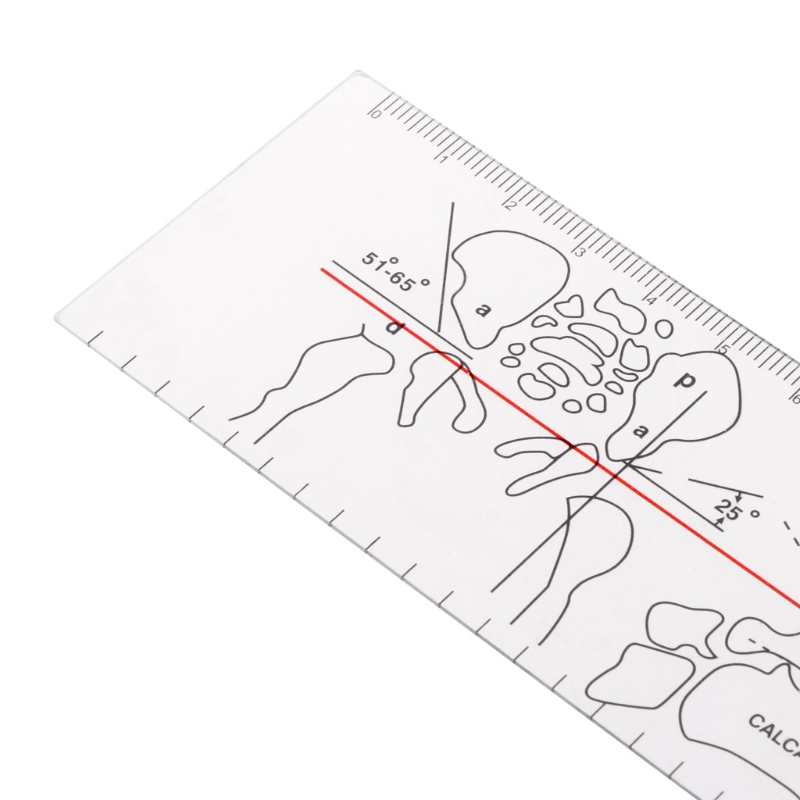 Long Jointing Ruler Goniometer Angle Ruler Rule Joint Orthopedics Tool... – Grandado
