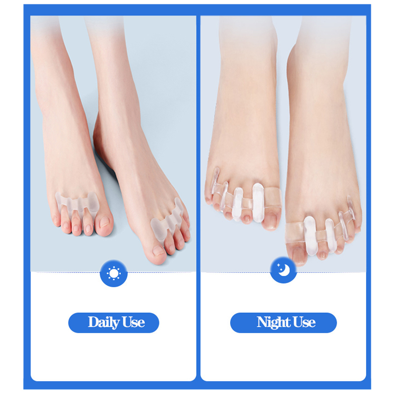 Silikon Zehen Separator Bunion Knochen Ektropion Einsteller Zehen Außen gerät Fußpflege Werkzeuge Hallux Valgus Korrektor