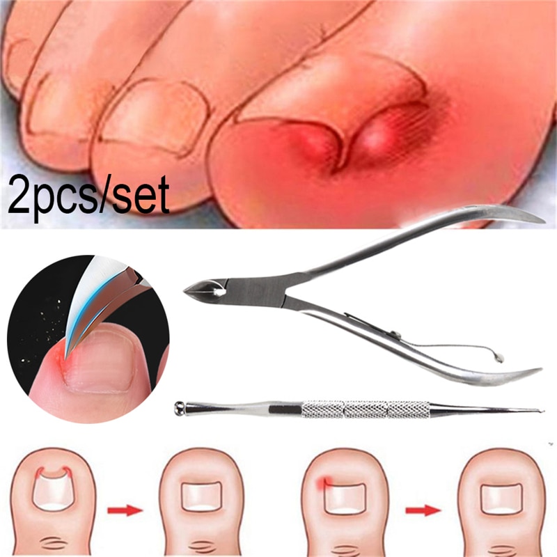 2 stücke Eingewachsene Finger Kappe Nagel Korrektur Zangen Nagel Clipper Schneider Toten Haut Schmutz Entferner Paronychie Podologie Pediküre Werkzeuge