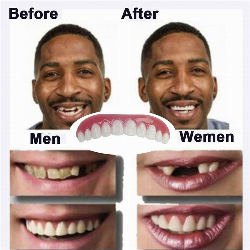 Dentaduras cosméticas para mujeres y hombres, cuidado bucal, belleza, superior/inferior