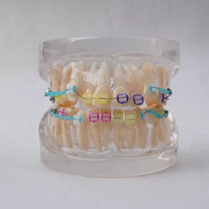 24pcs Tanden alle keramische beugel Orthodontie Tandheelkundige Model