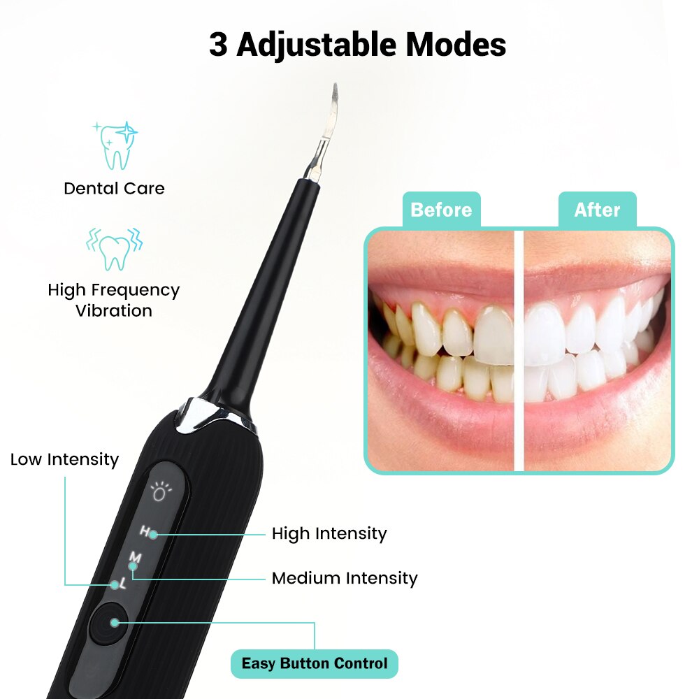 Portable Ultrasonic Tooth Cleaner Sonic Dental Scaler Oral Tartar Calculus Remover White Teeth Cleaning With Toothbrush Head