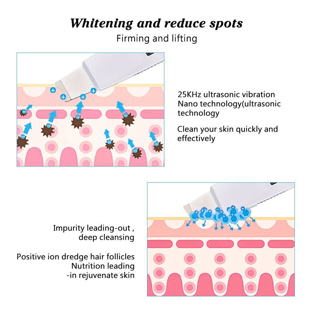 Limpiador Facial ultrasónico recargable, limpiador Facial, eliminación de espinillas por vibración, herramientas exfoliantes para limpieza de poros