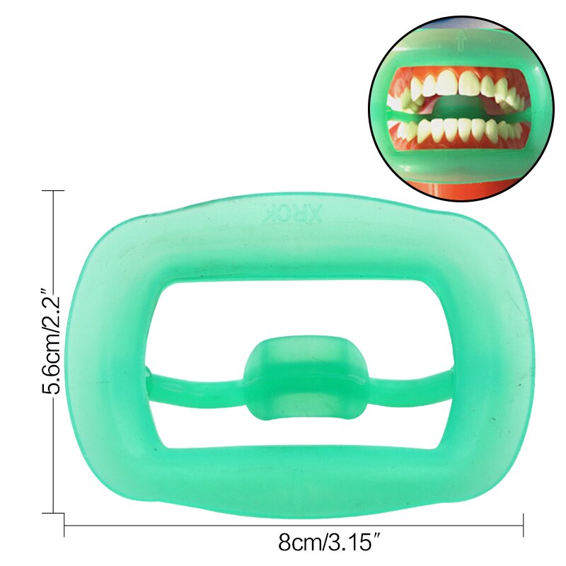 1Pc Dental Mond Opener Zachte Siliconen Lip Wang Oprolmechanisme Orthodontische Tanden Whitening Tandarts Gereedschap Instrument: Green