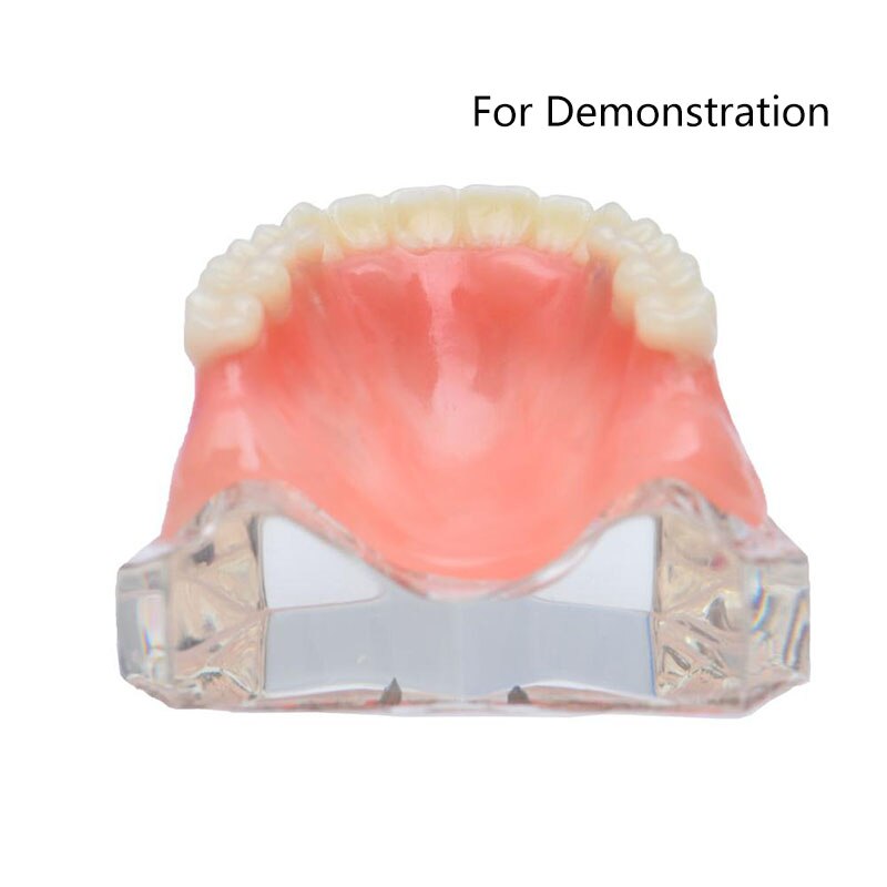 Dental Implant Teeth Teaching Model Overdenture Restoration Clear Removable Interior Maxillary Mandibular Tooth Demonstration