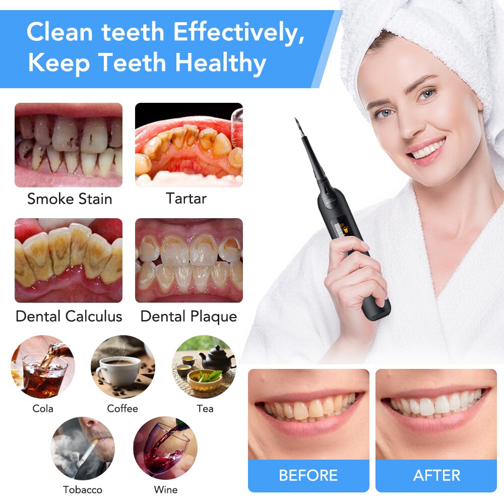 Détartreur dentaire électrique sonique Portable, dissolvant de tartre, taches, dentiste, blanchiment des dents, hygiène, santé, blanc