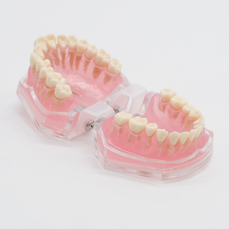 Modelo de enseñanza de goma suave extraíble, modelo tipodno para estudio de laboratorio Dental