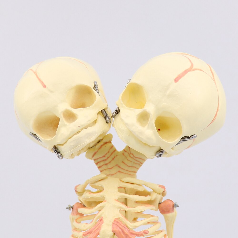 35CM crâne à deux têtes humain -né bébé Double tête anatomie crâne squelette anatomique éducation cérébrale modèle d'étude anatomique