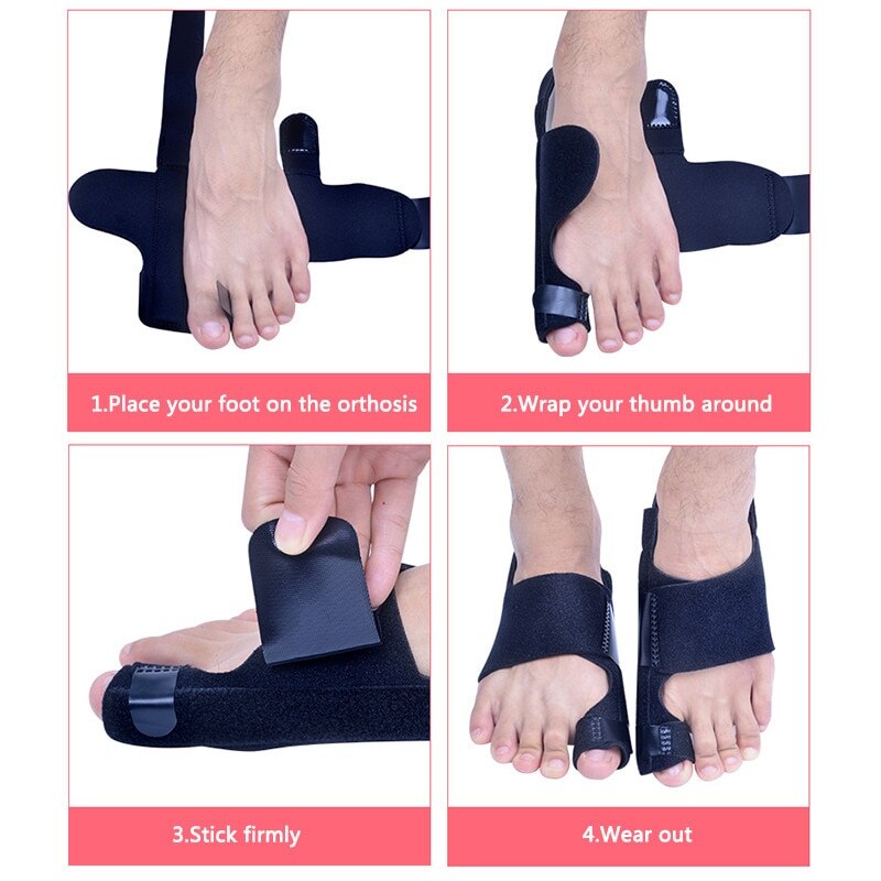 2 Pcs Bunion Corrector Spalk Toe Straightener Brace Hallux Valgus Pain Relief Voetverzorging Hallux Valgus Corrector Orthopedische Tool