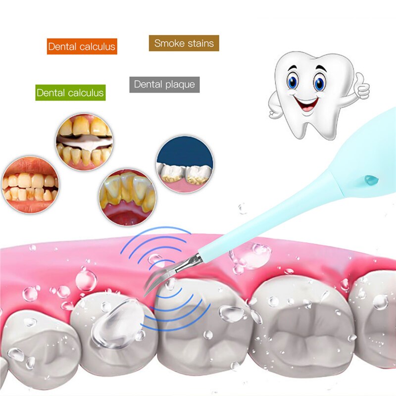 Ckeyin portátil elétrica dental calculus removedor escova de dentes sônica tártaro remoção dentes branqueamento limpeza ferramentas higiene oral 50