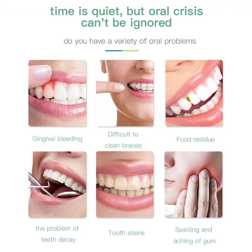 Portable Electric Oral Irrigator Waterproof Silent Teeth Cleaning Device Rechargeable Water Flosser Portable Dental Water Jet