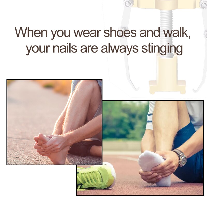 1Pcs Correction Toe Paronychia Nail Brace Tool Ingrown Toe Nail Pedicure Nail Tool Toenails Foot Pedicure Recover C1670-C1671