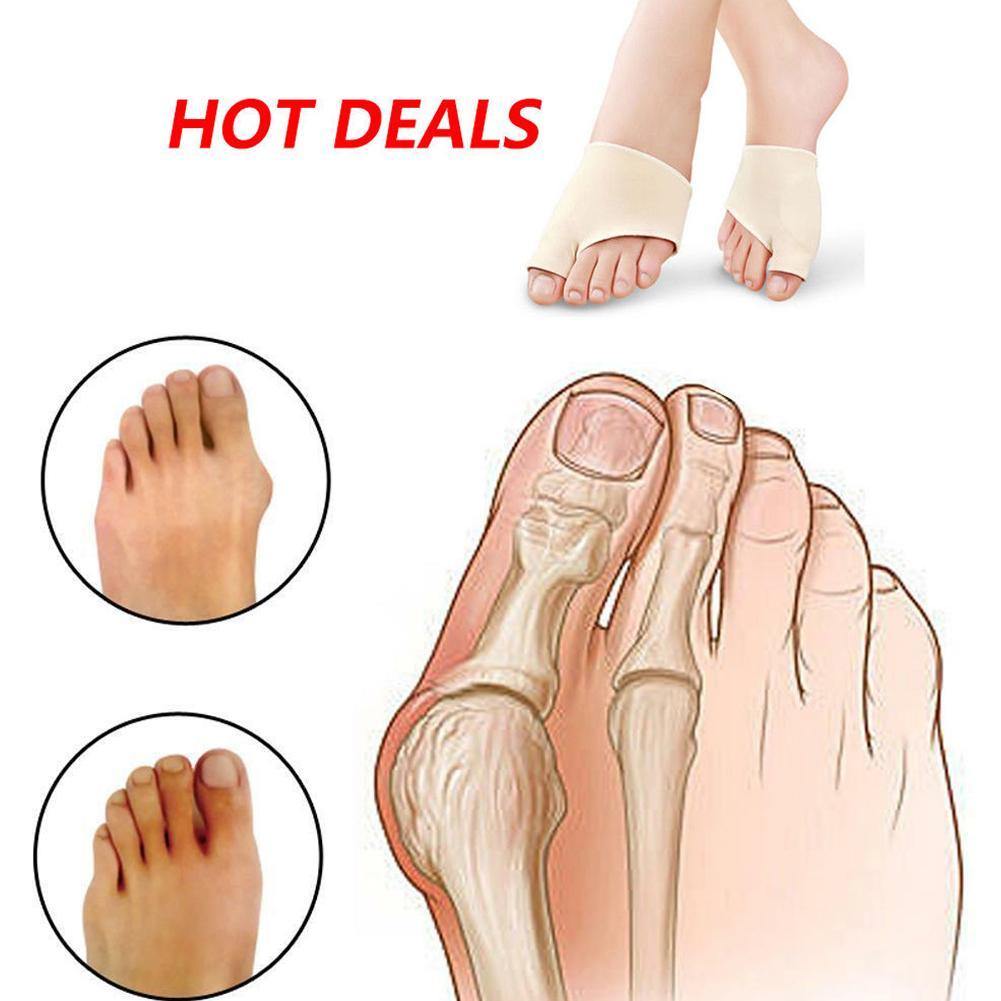 Storetå knyst skinne glattejern korrigerer fod smertelindring hallux valgus begge fødder terapi fodpleje let at have på