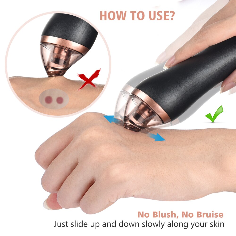Elektrische mee-eter verwijderaar, gezichtsreiniger, poriën stofzuiger, acne, puistjes zuigmachine, 4 in -in-1 body guasha cupping massage