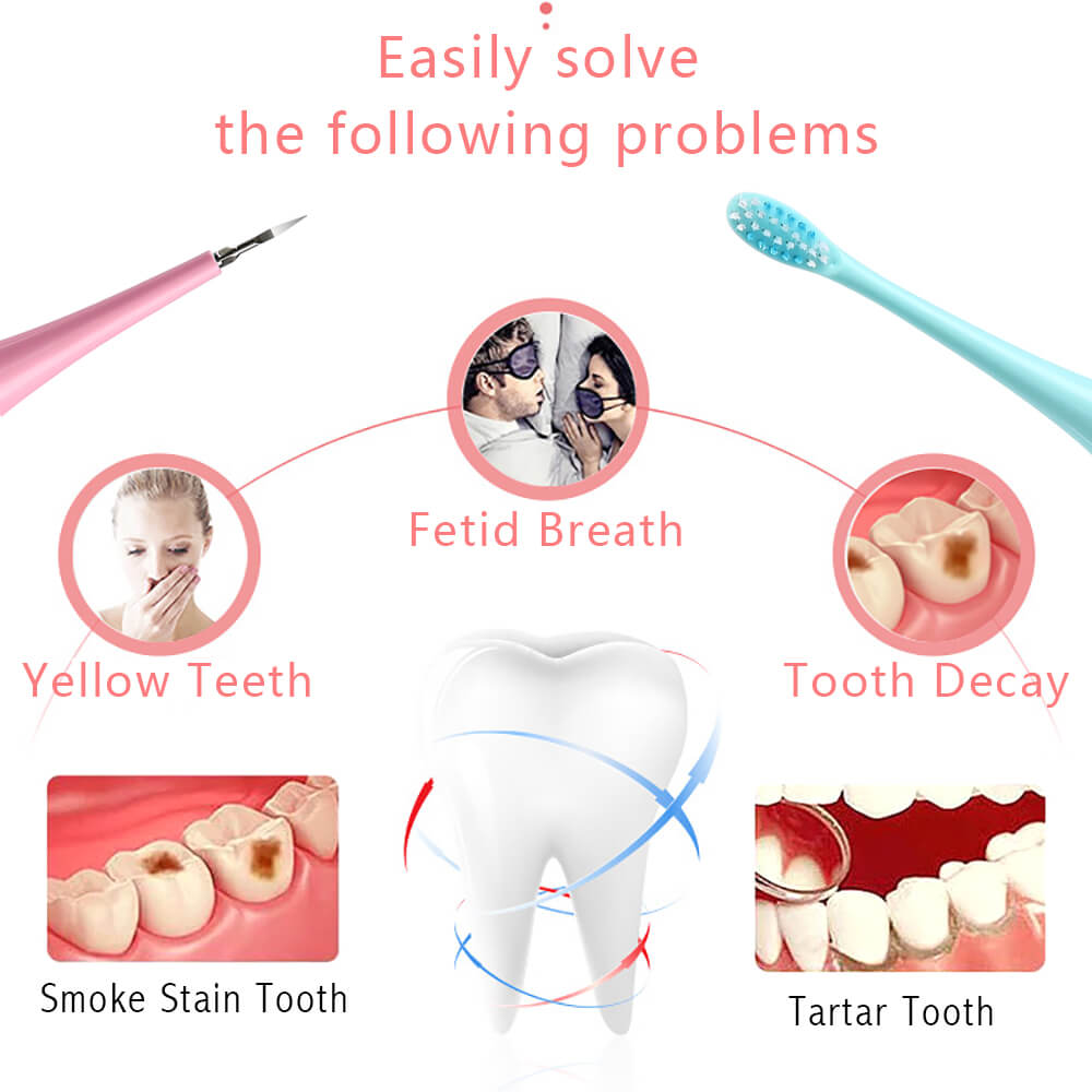 Sonic Elektrische Zahnbürste Rauch Zahnstein Reiniger Mundhygiene Tragbare Dental Scaler Zähne Bleaching Entfernung Flecken Zahnarzt Kopf