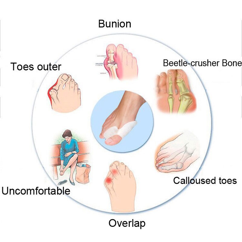 50 Pairs Siliconen Hallux Valgus Gel Bunion Manicure Teen Separator Voeten Pijnbestrijding Guard Plantillas Para Los Pies Voeten Zorg Tool