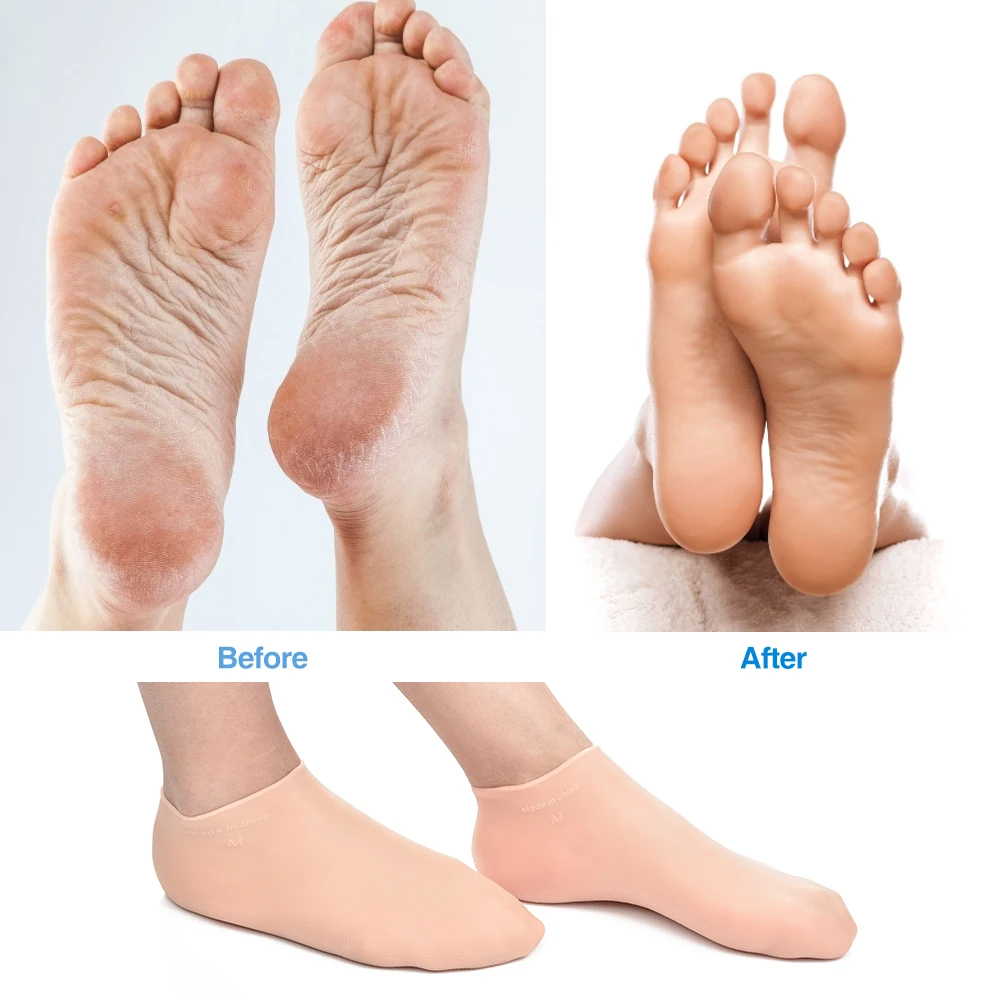 Calcetines de traje de neopreno de silicona para aletas de natación, zapatos de rana, parte trasera antideslizante, cómodas calcetines de agua para playa, calcetines de buceo y snorkel