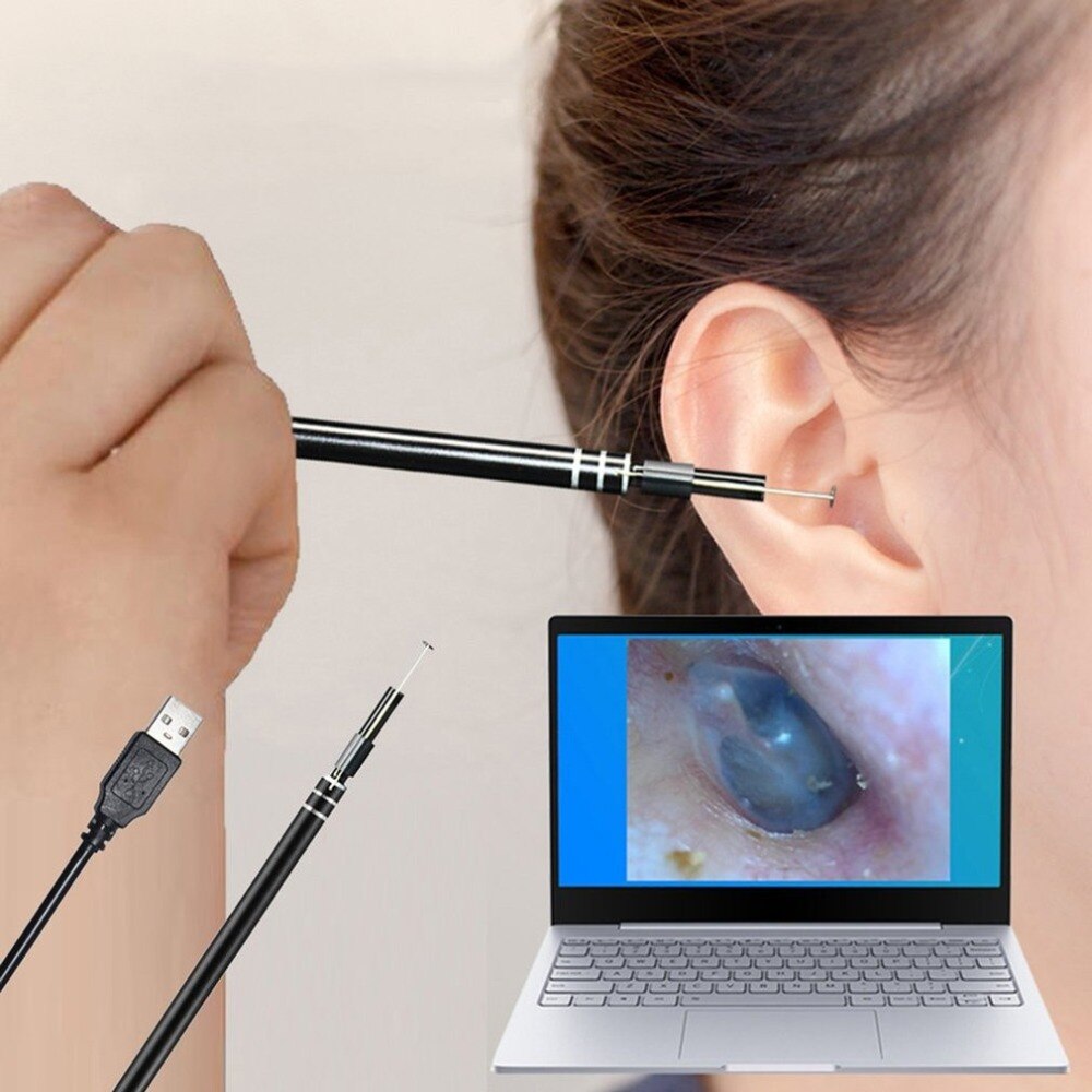 Outil de nettoyage d'oreille USB multifonctionnel, bâton visuel avec HD pour le nettoyage des oreilles et le nettoyage de Mini caméra Endoscope