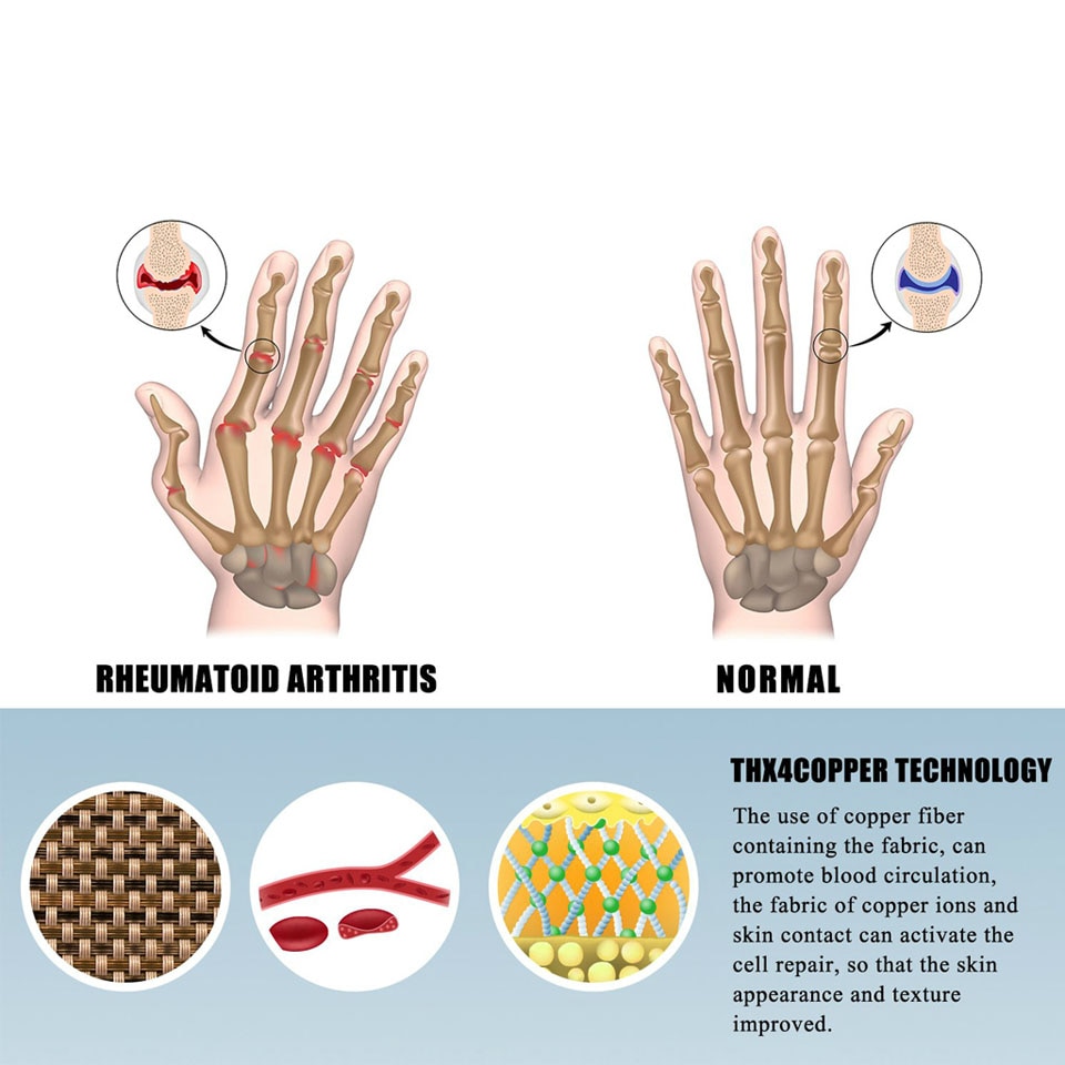 Blue Jay Arthritis Gloves XS (6 - 6 3/4) - Compression Gloves for Hand Pain Relief - 1 Pair