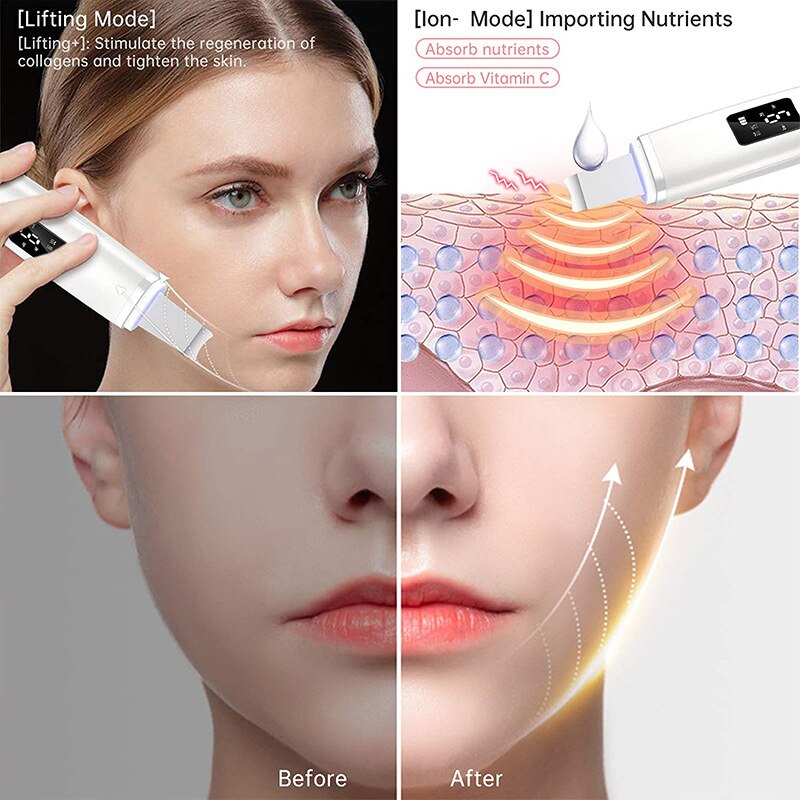 Facial Skin Exfoliator Device Face Lifting Tool EMS Ion Ultrasonic Skin Scrubber Peeling Beauty Machine