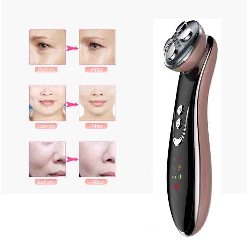 RF Radio Cold Eye Facial Multifunction 5 in 1 LED Photon Skin Care Device Face Skin EMS Mesotherapy Massager