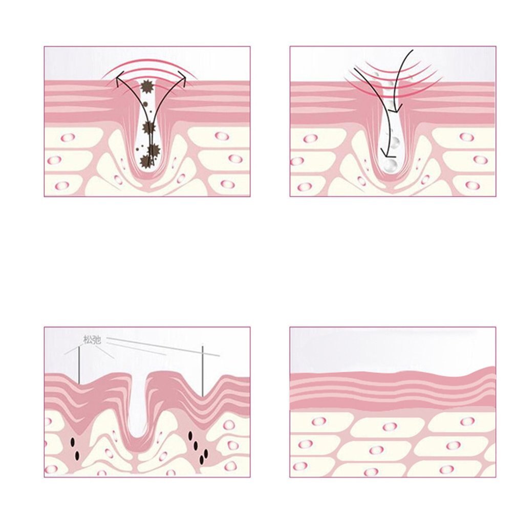 Hals Care Anti-Rimpel Schoonheid Apparaat Nek Massage Schoonheid Hals Apparaat Multifunctionele Praktische Zorg Apparaat