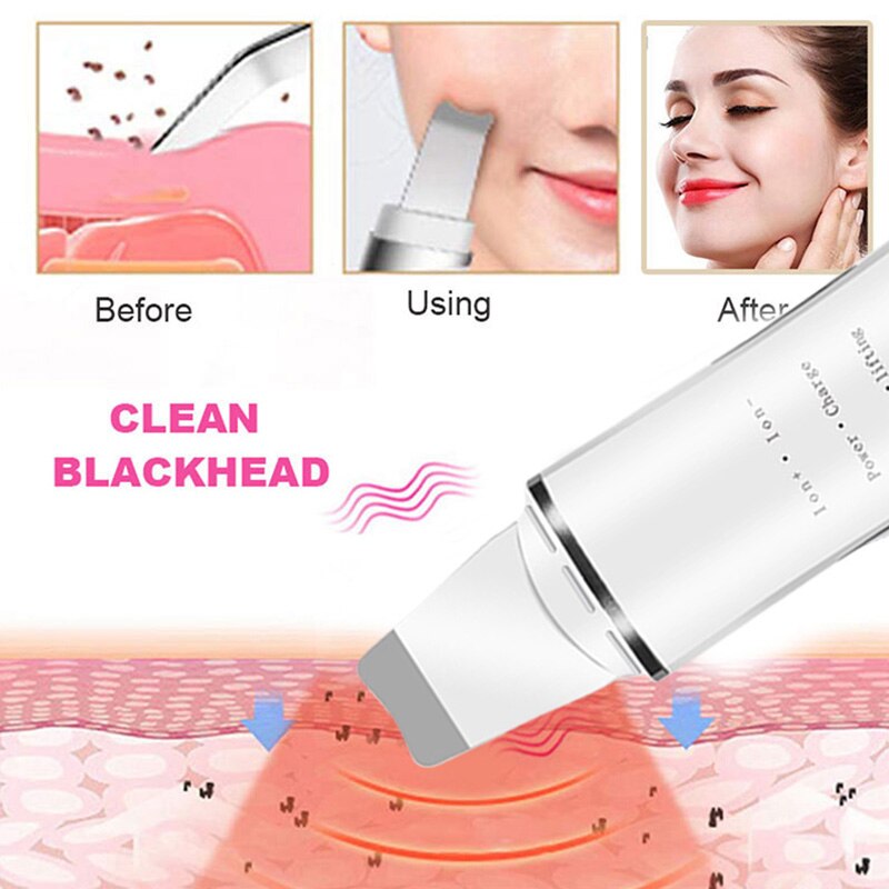 Diepe Reiniging Gezicht Scrubber Ultrasone Huid Scrubber Vibrerende Gezichtsreiniging Huid Spatel Peeling Schoonheid Instrument