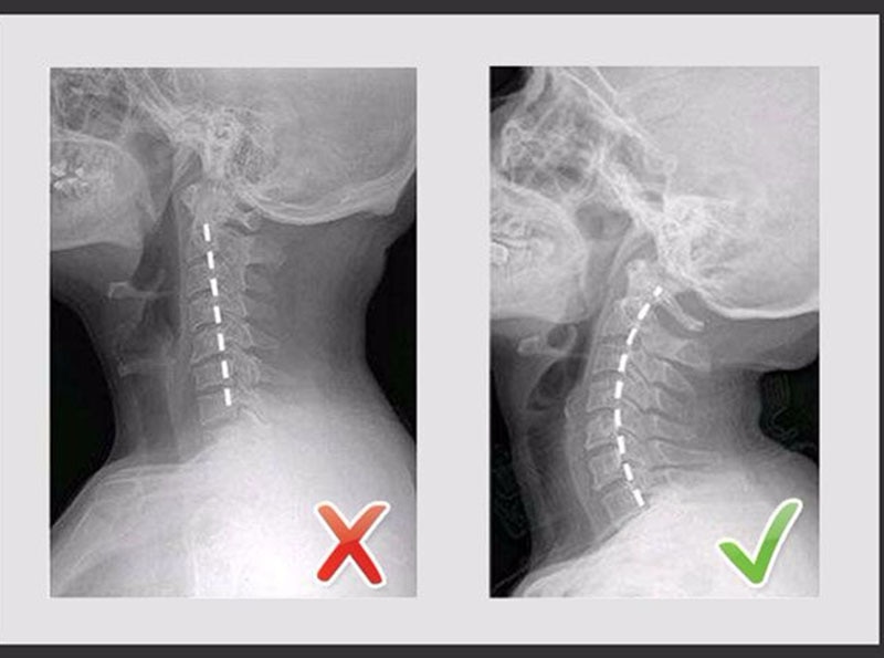 Portable Air Inflatable Neck Brace Device Headache Back Shoulder Pain Cervical Traction Comfortable Neck Massage Relaxation