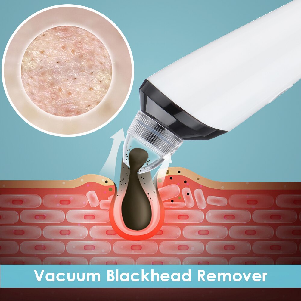 WiFi Camera Visual Face Blackhead Remover Vacuum Suction Pore Cleaner Face Deep Nose Cleasning Pimple Removal With 3 heads Tool