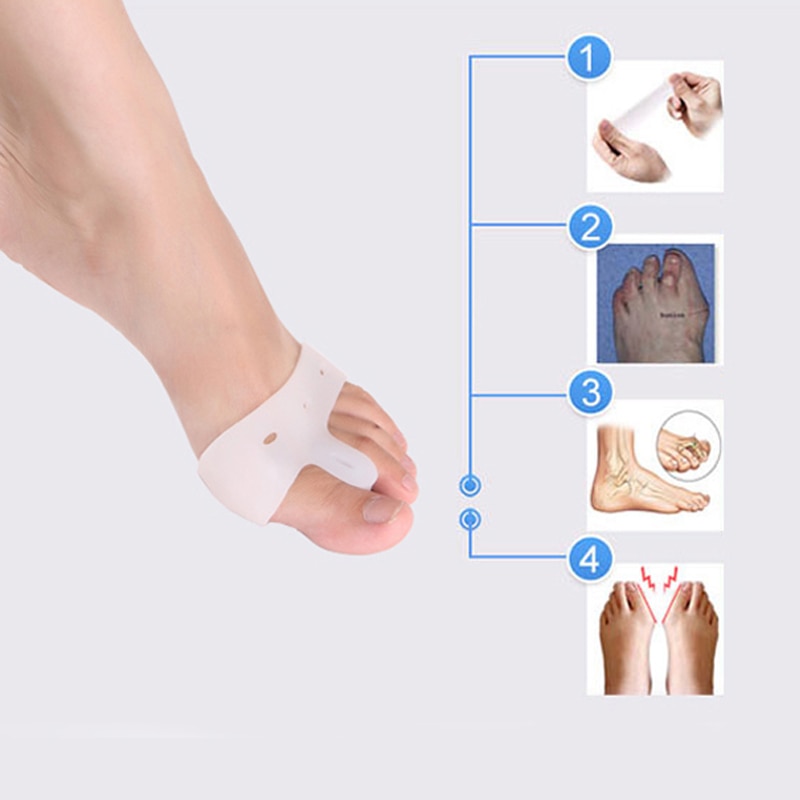 1pair=2pcs Genuine Special Hallux Valgus Bicyclic Thumb Orthopedic Braces Toe Corrector Daily Silicone Toe Big Bone Bunion
