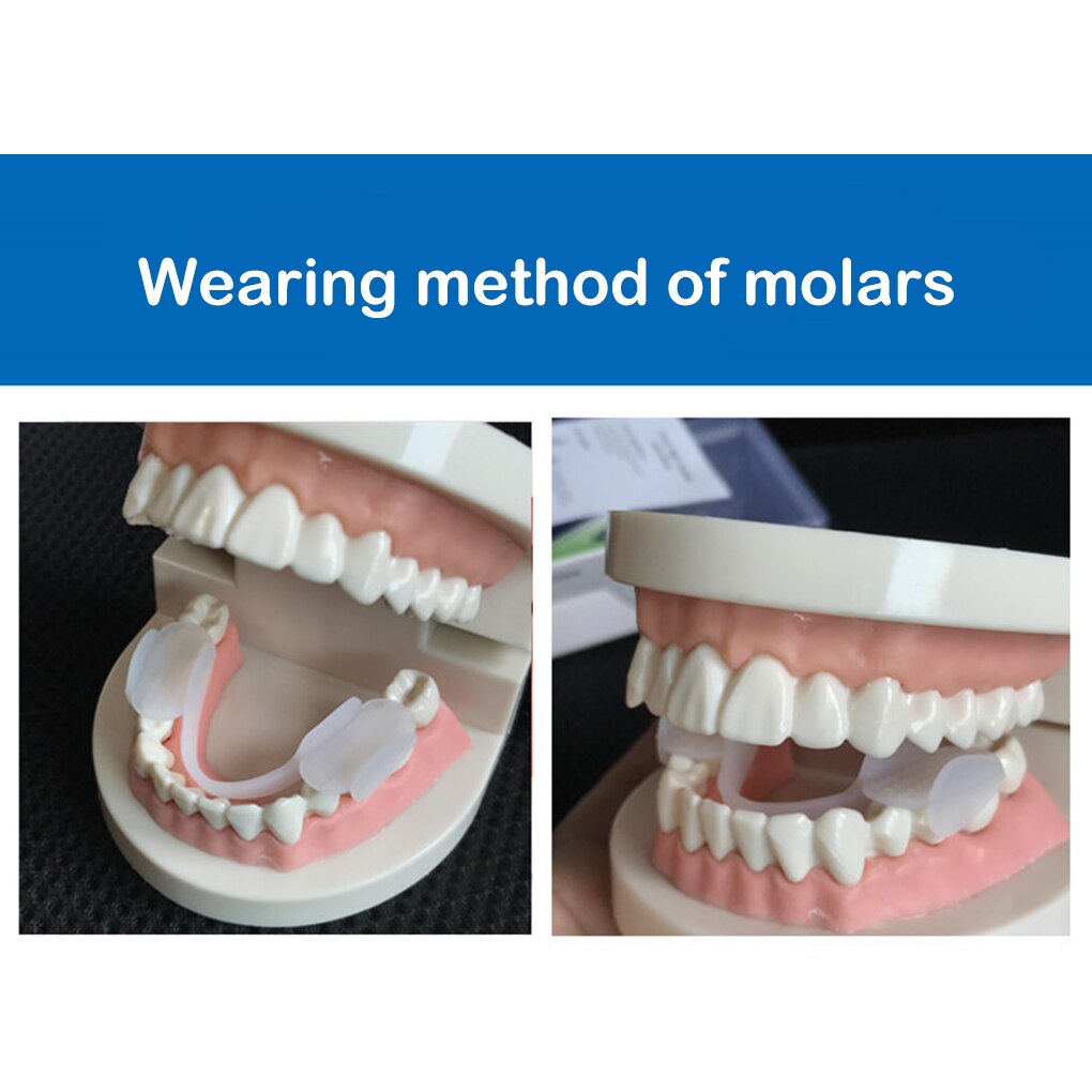 Mond Molaire Protector Tanden Guard Tand Slijpen Night Tray Protector Anti Snurken Aid Dental Care Tool Silicone Tand Guard